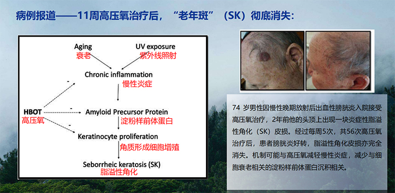 微壓氧艙3.jpg 微壓氧艙3.jpg